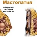 Климадинон інструкція із застосування, ціна, відгуки, аналоги (інструкція) Климадинон інструкція із застосування, ціна, відгуки, аналоги