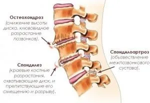Клініка здорового хребта стаєр ціни лікування і відгуки пацієнтів (ціни) Клініка здорового хребта стаєр ціни лікування і відгуки пацієнтів