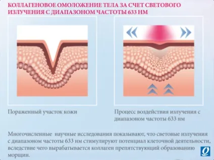 Коллагенарій - прості відповіді на складні питання ... (питання) Коллагенарій - прості відповіді на складні питання ...