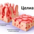 Чорний пронос причини виникнення, симптоми і лікування (причини) Чорний пронос причини виникнення, симптоми і лікування