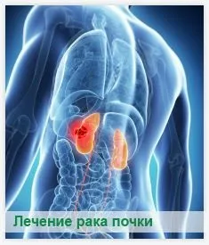 Лікування раку нирок народними засобами - бабусині методи лікування! (Двох столових ложок) Лікування раку нирок народними засобами - бабусині методи лікування!