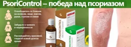 Лікування псоріазу лазером і відгуки (лікування) Лікування псоріазу лазером і відгуки