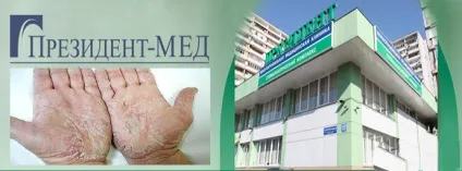 Лікування псоріазу в москві клініки, медичні центри (псоріазу) Лікування псоріазу в москві клініки, медичні центри