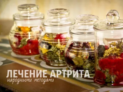 Лікування артриту травами і народними методами (лікування) Лікування артриту травами і народними методами