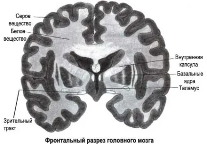Лейкоареоз головного мозку лікування, діагностика і стадії (мозок лейкоареоз кора ознака структура подкорковая) Лейкоареоз головного мозку лікування, діагностика і стадії