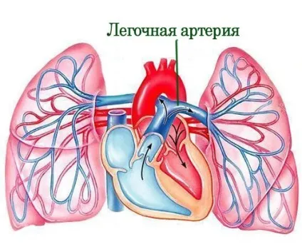 Легенева артерія, хвороби легеневої артерії (артерії) Легенева артерія, хвороби легеневої артерії