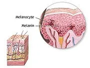 Меланоціт - це