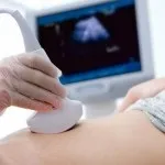 Чи можна вірити узі з визначення статі (визначенням) Чи можна вірити узі з визначення статі