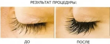 Чи можна реп'яхову олію використовувати для вій як наносити і користуватися, спосіб застосування для (використовувати) Чи можна реп'яхову олію використовувати для вій як наносити і користуватися, спосіб застосування для