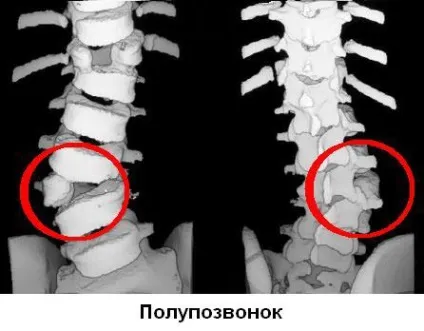 Мрт (обстеження) хребта як проходить процедура (проходить) Мрт (обстеження) хребта як проходить процедура