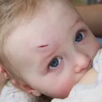 Що робити, якщо дитина набив шишку на голові