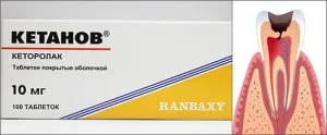 Що робити, якщо застудив зуб, як це лікувати симптоми запалення зубного нерва (лікувати) Що робити, якщо застудив зуб, як це лікувати симптоми запалення зубного нерва