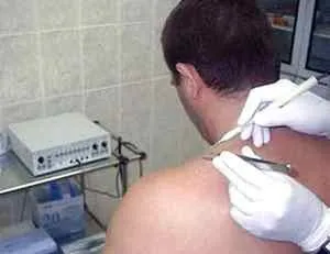 Небезпечні родимки на тілі як розпізнати і як уникнути біди (небезпечні) Небезпечні родимки на тілі як розпізнати і як уникнути біди