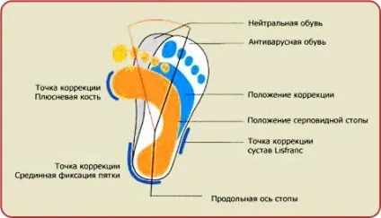 Ортопедичне антіварусная взуття для дітей - поради експертів (антіварусная) Ортопедичне антіварусная взуття для дітей - поради експертів