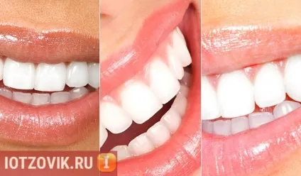 Відбілюючий олівець для зубів luxury white, відгуки покупців