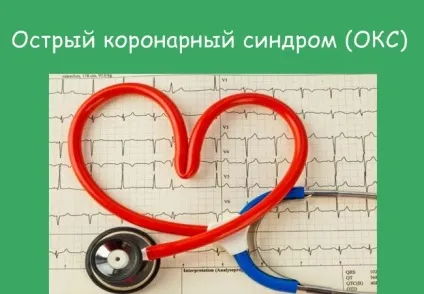 Гострий коронарний синдром клініка, діагностика, лікування (гострий) Гострий коронарний синдром клініка, діагностика, лікування