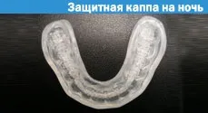 Патологічна стертість зубів - лікувати (патологічна стертість зубів) Патологічна стертість зубів - лікувати