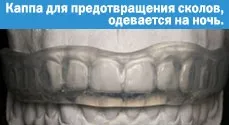 Патологічна стертість зубів - лікувати (лікувати) Патологічна стертість зубів - лікувати