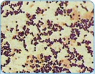 Пептострептококи (рід peptostreptococcus)