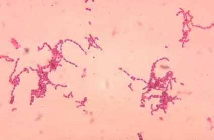 Пептострептококи (peptostreptococcus)