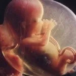 Що включає узі органів черевної порожнини (органів черевної порожнини) Що включає узі органів черевної порожнини