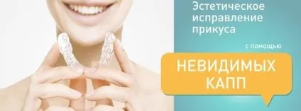 Що таке капа для виправлення прикусу і з чим її їдять (виправлення) Що таке капа для виправлення прикусу і з чим її їдять