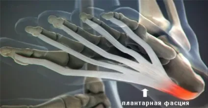 Чому болять п'яти у дорослого і дитини чому болить п'яткова кістка або ліва п'ятка (болять) Чому болять п'яти у дорослого і дитини чому болить п'яткова кістка або ліва п'ятка