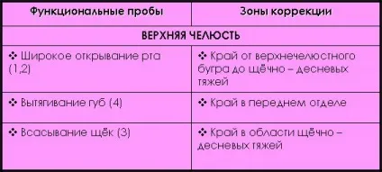 Припасування знімного протезу