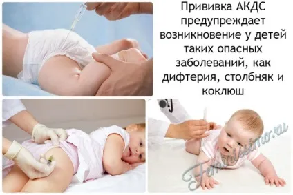Щеплення АКДС - розшифровка, реакція на вакцину і чи варто її робити (розшифровка) Щеплення АКДС - розшифровка, реакція на вакцину і чи варто її робити
