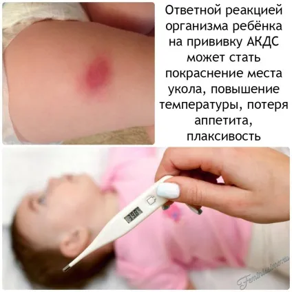 Щеплення АКДС - розшифровка, реакція на вакцину і чи варто її робити (реакція) Щеплення АКДС - розшифровка, реакція на вакцину і чи варто її робити