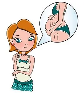Розтяжки при вагітності, mammyclub (ймовірність появи розтяжок) Розтяжки при вагітності, mammyclub