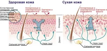 Чутлива шкіра причини, догляд і лікування, медафарм - портал про пластичну хірургію, медичному (чутлива шкіра) Чутлива шкіра причини, догляд і лікування, медафарм - портал про пластичну хірургію, медичному