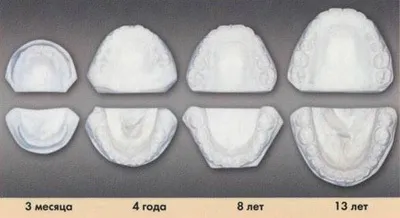 зростання щелеп