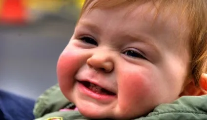 Симптоми того, що у малюка ріжуться зубки (ріжуться верхні зубки симптоми) Симптоми того, що у малюка ріжуться зубки