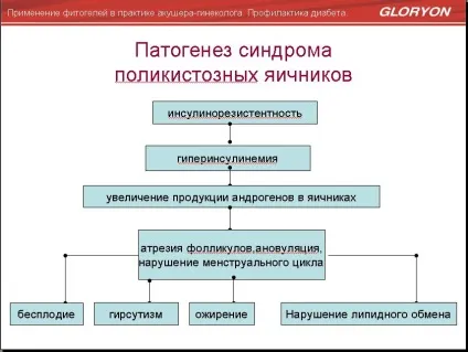 Синдром Штейна-Левенталя що це таке (синдром) Синдром Штейна-Левенталя що це таке