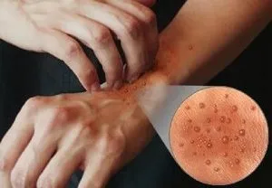 Солярій користь і шкода