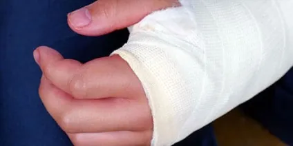 Сонник зламана рука до чого сниться зламана рука уві сні (рука) Сонник зламана рука до чого сниться зламана рука уві сні