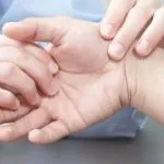 Стандарт лікування остеохондрозу хребта (хребта) Стандарт лікування остеохондрозу хребта