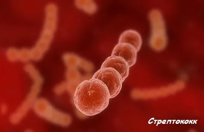 Стафілококова пневмонія у дорослих симптоми, лікування і причини (лікування) Стафілококова пневмонія у дорослих симптоми, лікування і причини