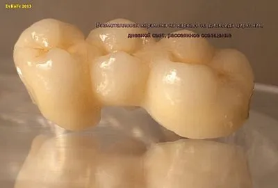 Стоматологічні керамічні маси в ультрафіолетовому світлі (маси) Стоматологічні керамічні маси в ультрафіолетовому світлі