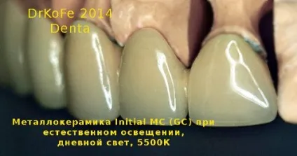 Стоматологічні керамічні маси в ультрафіолетовому світлі (кераміка в ультрафіолеті) Стоматологічні керамічні маси в ультрафіолетовому світлі
