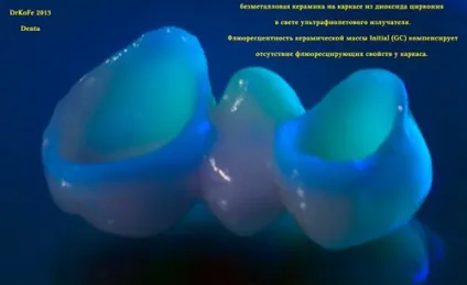 Стоматологічні керамічні маси в ультрафіолетовому світлі (кераміка в ультрафіолеті) Стоматологічні керамічні маси в ультрафіолетовому світлі