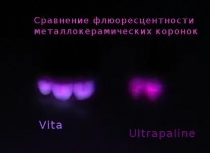Стоматологічні керамічні маси в ультрафіолетовому світлі (керамічні) Стоматологічні керамічні маси в ультрафіолетовому світлі