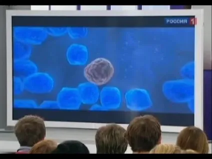 Стафілококова пневмонія у дорослих симптоми, лікування і причини (пневмонія) Стафілококова пневмонія у дорослих симптоми, лікування і причини