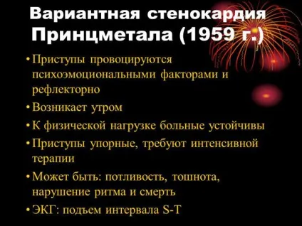 Стенокардія Принцметала (спонтанна, варіантна, вазоспастична) - причини, симптоми, лікування (причини) Стенокардія Принцметала (спонтанна, варіантна, вазоспастична) - причини, симптоми, лікування