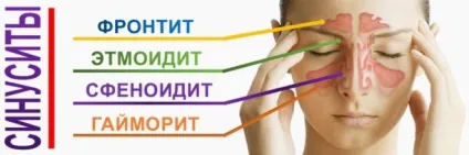 Таблетки силует відгуки при ендометріозі і інструкція із застосування (відгуки) Таблетки силует відгуки при ендометріозі і інструкція із застосування