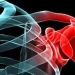 Травми плечового суглоба симптоми і лікування плеча (травми) Травми плечового суглоба симптоми і лікування плеча
