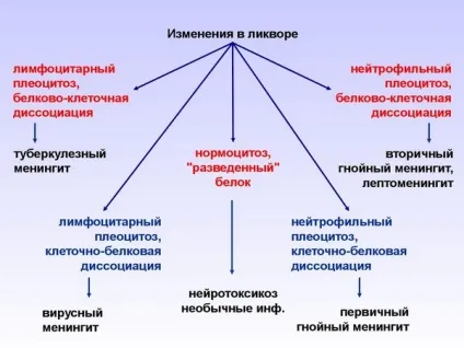 Туберкульозний менінгіт, симптоми і лікування, діагностика, як передається (симптоми) Туберкульозний менінгіт, симптоми і лікування, діагностика, як передається
