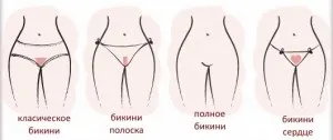 Видалення лобкових волосся в перший раз - здоров'я і стиль життя жінок (волосся) Видалення лобкових волосся в перший раз - здоров'я і стиль життя жінок