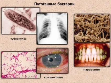 Знищення в навколишньому середовищі патогенних мікроорганізмів називається дезінфекцією